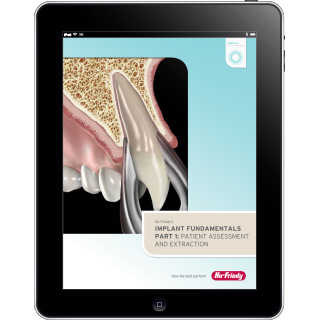 Implant Fundamentals eBook Series
